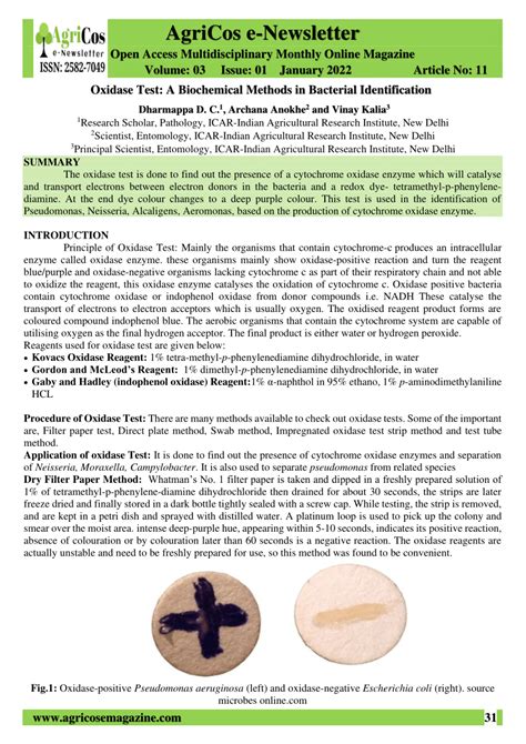 Oxidase test: A biochemical method in bacterial identification.